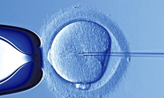 Justica-concede-a-casal-direito-de-reproducao-humana-assistida-apos-acao-da-Defensoria-Publica-da-Uniao