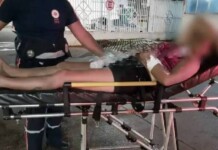 Mulher é esfaqueada após ser assaltada e ter objetos roubados no Acre