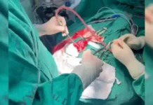 Criança de 3 anos vítima de atropelamento no ramal 3 em Cruzeiro do Sul realiza neurocirurgia no Hospital do Juruá