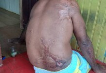 VÍDEO: jornalistas lançam campanha para ajudar pai de família deficiente físico que teve motocicleta aprendida em Cruzeiro do Sul