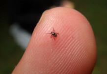 No Acre, mulher é diagnosticada com doença do carrapato