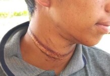 No interior do Acre, adolescente quase morre ao tentar laçar vaca e ter corda enrolada no pescoço