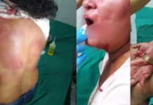 Mulher é resgatada pela polícia após ter cabelo, roupas e corpo cortados com faca pelo marido no Acre