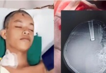 Em Rodrigues Alves, adolescente fica com cartucho no crânio após tentar matar mucura