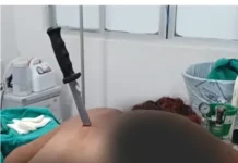 Mulher tem faca cravada nas costas pelo ex companheiro em Tarauacá