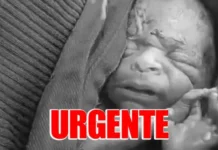 Bebê que “ressuscitou” após ser declarado morto não resiste e falece na UTI de hospital