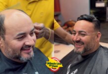 VÍDEO: barbearia de Mâncio Lima impressiona ao realizar implante capilar; serviço é pioneiro e inovador