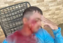 Agressor grava áudio e pede desculpas após atingir gari com tijolo em Rio Branco: “cabeça quente”