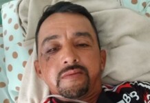 Gari agredido com tijolada vai passar por cirurgia para colocar pinos no rosto: ‘Nunca bati em ninguém’