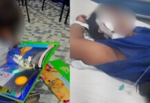 Aluno de 10 anos perde visão de um olho após agressão em escola