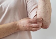 ‘Quase morri e não emagreci’: pacientes relatam reações graves após usar canetas emagrecedoras falsificadas