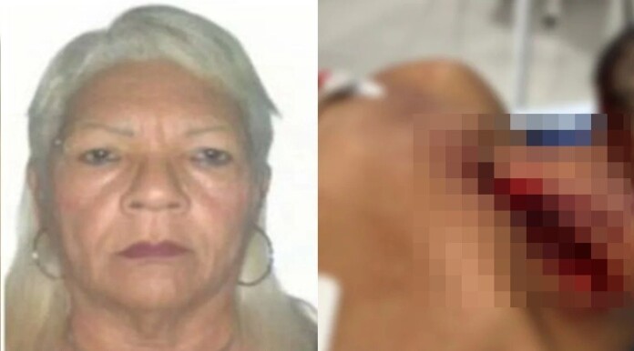 a-mulher-provocou-o-corte-profundo-usando-uma-navalha-0f96ad99263da62f