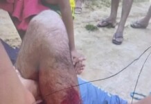 Homem é ferido por disparo acidental durante caçada em Mâncio Lima