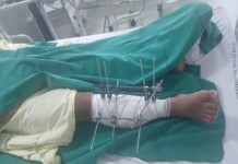 Mâncio Lima: indígena Puyanawa passa por cirurgia após disparo acidental durante caçada