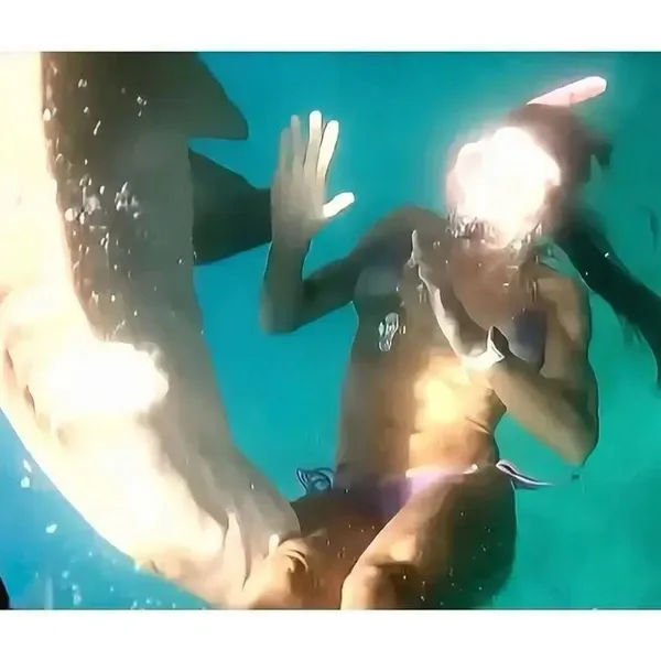 advogada-foi-mordida-por-tubarao-e-ficou-com-cicatriz-na-perna-3224957-article