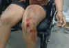 Mulher é agredida durante assalto e tem motocicleta roubada em Cruzeiro do Sul