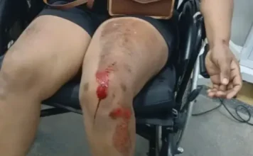 Mulher é agredida durante assalto e tem motocicleta roubada em Cruzeiro do Sul